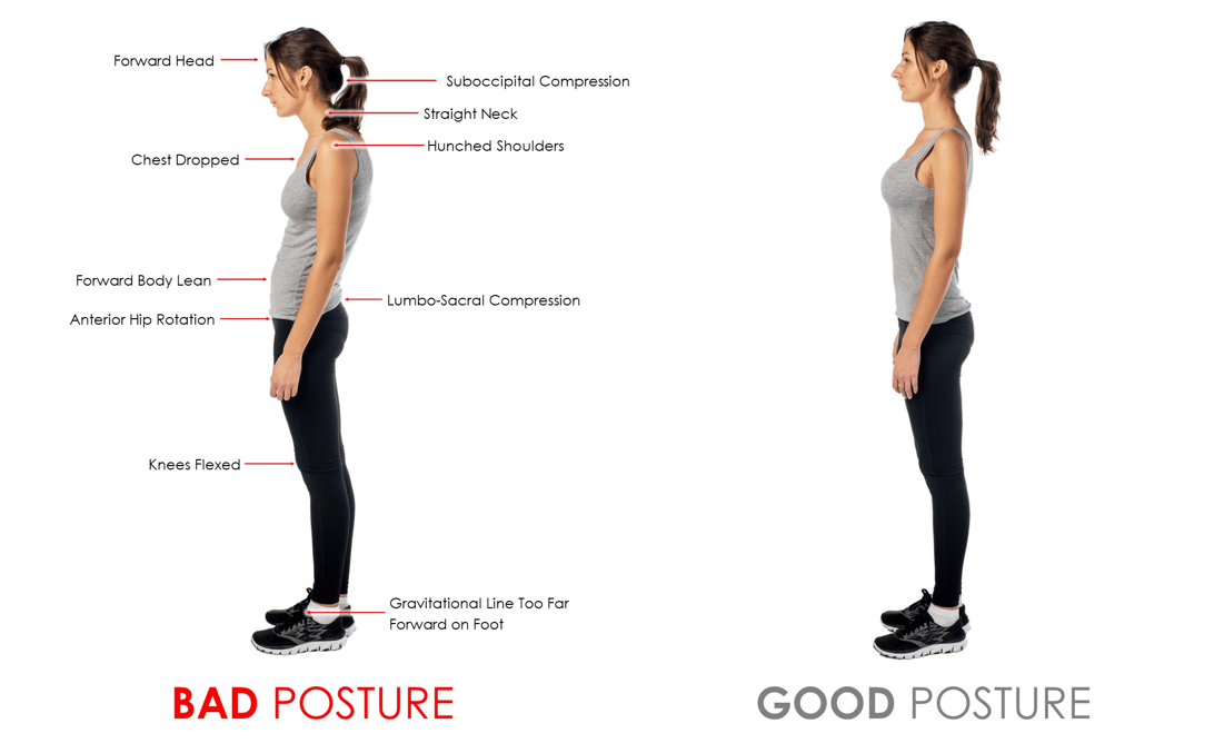 https://www.serola.net/wp-content/uploads/2022/03/Bad-vs-Good-Posture-1.png