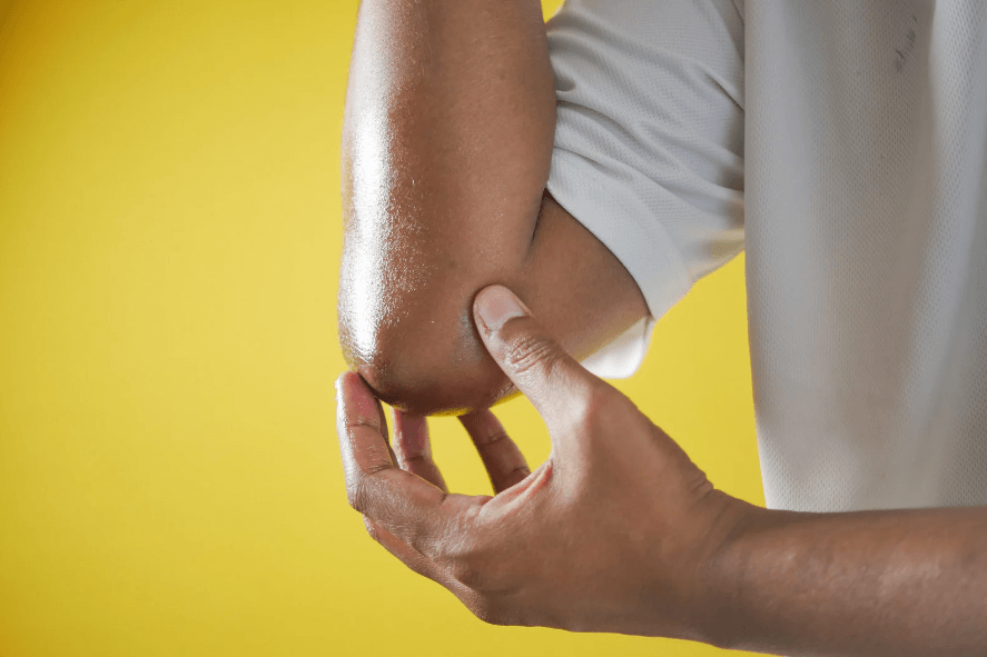 A person holds their elbow on each side.